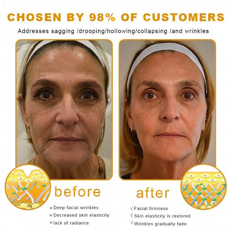 【Official Shop】RAINDEW® 9-IN-1 BEE VENOM & GHK-Cu Skin Firming & Treatment Cream Anti-aging, Hydrating, Skin Repair, Even Tone, Acne and Dark Spot Treatment, Wart and Mole Removal, Psoriasis Relief