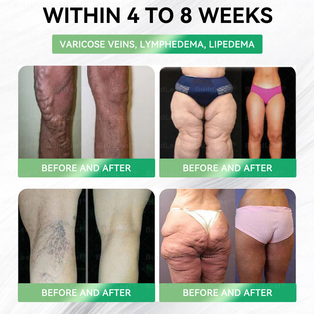 🚀MyoClinic GL𝐏-1 8-𝒊𝒏-1 𝙁𝙞𝙩 & 𝙑𝙞𝙩𝙖𝙡 𝖮𝗋𝖺𝗅 𝙎𝙤𝙡𝙪𝙩𝙞𝙤𝙣  (𝑱𝒖𝒔𝒕 𝒐𝒏𝒄𝒆 𝒂 𝒅𝒂𝒚, 𝒗𝒊𝒔𝒊𝒃𝒍𝒆 𝒄𝒉𝒂𝒏𝒈𝒆𝒔 𝒊𝒏 7 𝒅𝒂𝒚𝒔) ✅ 𝑭𝒐𝒓 𝒐𝒃𝒆𝒔𝒊𝒕𝒚, 𝒄𝒂𝒓𝒅𝒊𝒐𝒗𝒂𝒔𝒄𝒖𝒍𝒂𝒓 𝒉𝒆𝒂𝒍𝒕𝒉, 𝒅𝒊𝒂𝒃𝒆𝒕𝒆𝒔, 𝒔𝒍𝒆𝒆𝒑 𝒂𝒑𝒏𝒆𝒂, 𝒈𝒖𝒕 𝒉𝒆𝒂𝒍𝒕𝒉, 𝒋𝒐𝒊𝒏𝒕 𝒊𝒔𝒔𝒖𝒆𝒔, 𝒂𝒏𝒅 𝒎𝒐𝒓𝒆