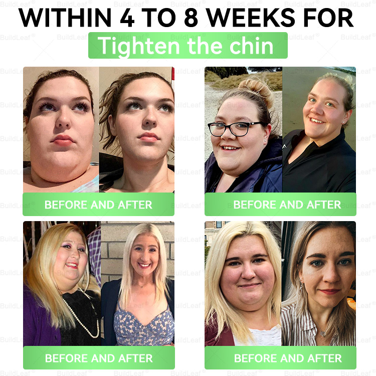 ðºðž US Online | Honxi® GLP-1 9-in-1 Slim & Healthy Oral Solution(ðððð ð ðððŠ, ð£ðð ðððð ððð ð¢ðð¡ð  ðð 7 ðððŠð )  â
 ðŠððœðœðŒð¿ðð ðŒð¯ð²ðð¶ðð, ð°ð®ð¿ð±ð¶ðŒðð®ðð°ðð¹ð®ð¿ ðµð²ð®ð¹ððµ, ð±ð¶ð®ð¯ð²ðð²ð, ðð¹ð²ð²ðœ ð®ðœð»ð²ð®, ðŽðð ðµð²ð®ð¹ððµ, ð·ðŒð¶ð»ð ð¶ðððð²ð, ð°ð¡ð¢ð¥ð ðð¥ð¬ðš ðð¢ð«ðŠð¢ð§ð  ðð¡ð ð¬ð€ð¢ð§ ðð§ð ððšðšð¬ðð¢ð§ð  ðð§ðð«ð ð².