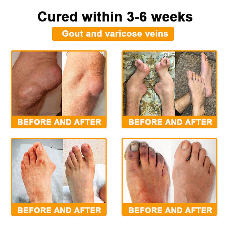 🇺🇸Myo Clinic BEE VENOM LITHOSPERMUM Pain-Relief Bone Healing Cream 👑(Specially for older adults)