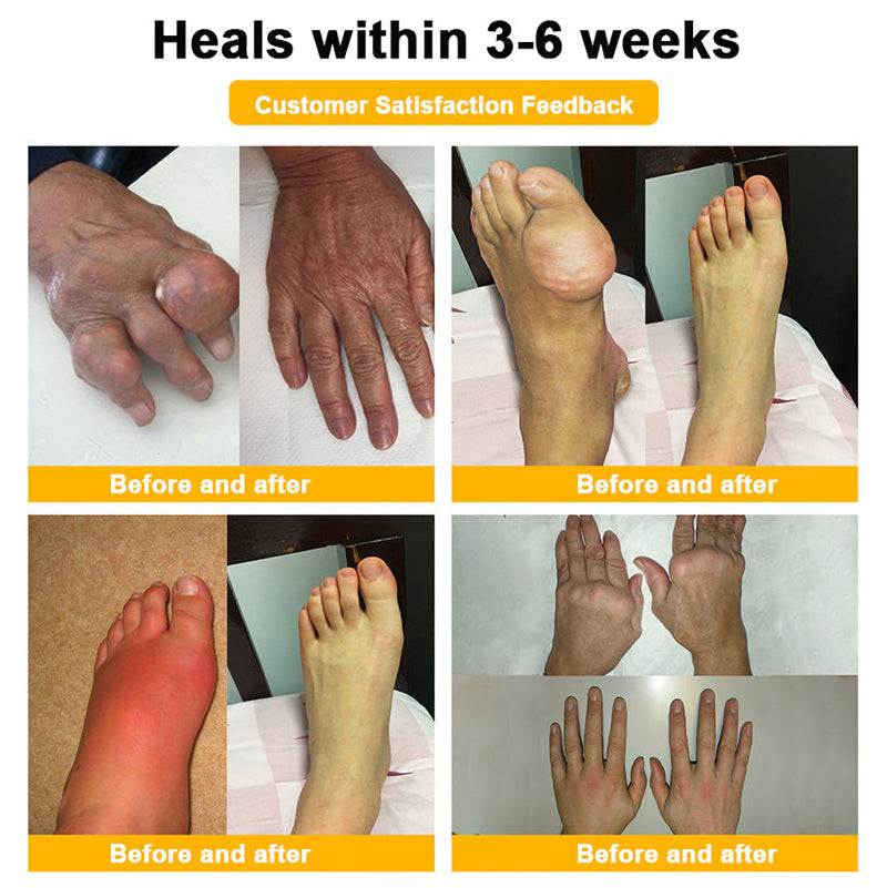 🇺🇸Myo Clinic BEE VENOM LITHOSPERMUM Pain-Relief Bone Healing Cream 👑(Specially for older adults)