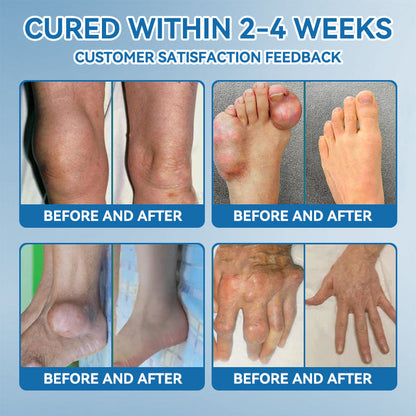 🇺🇸 LOTMAY® BPC-157 Joint & Muscle Treatment Cream🦴Treats Arthritis, Neuropathy, Rheumatism, Sports Injuries & More 🌹