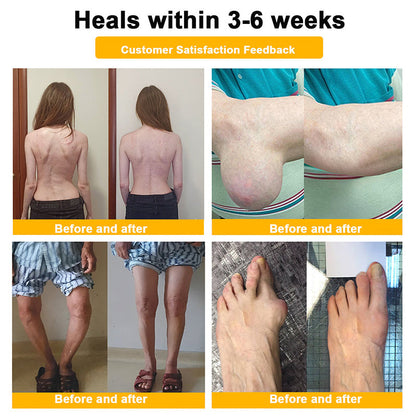 🇺🇸Myo Clinic BEE VENOM LITHOSPERMUM Pain-Relief Bone Healing Cream 👑(Specially for older adults)