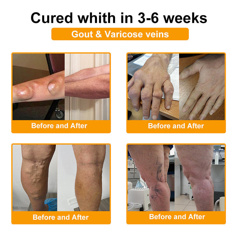 🇺🇸Myo Clinic BEE VENOM LITHOSPERMUM Pain-Relief Bone Healing Cream 👑(Specially for older adults)