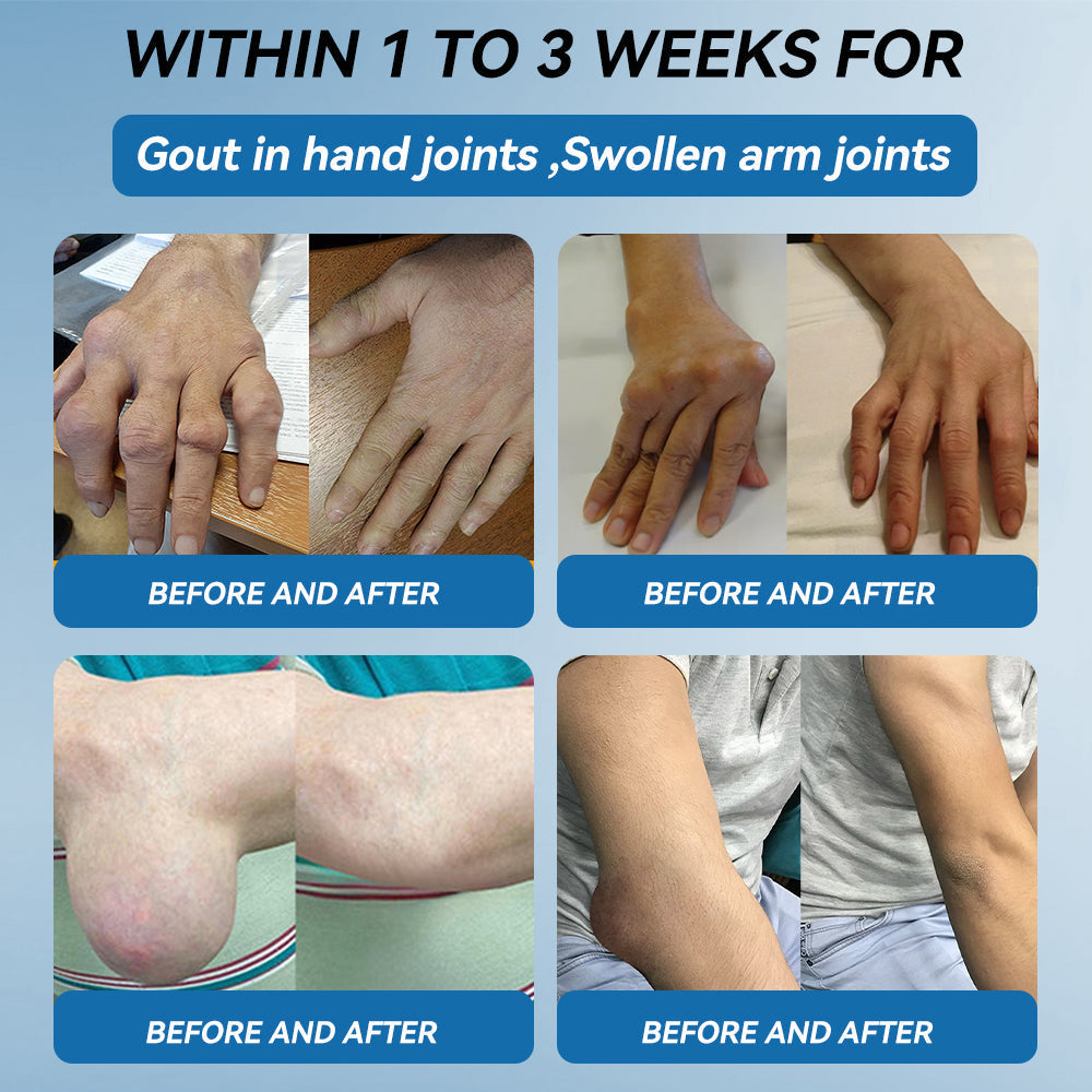 🇺🇸 LOTMAY® BPC-157 Joint & Muscle Treatment Cream🦴Treats Arthritis, Neuropathy, Rheumatism, Sports Injuries & More 🌹