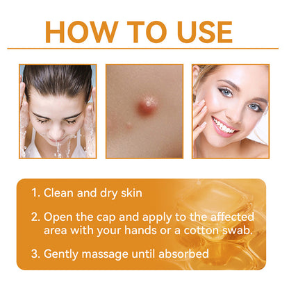 【Official Shop】RAINDEW® 9-IN-1 BEE VENOM & GHK-Cu Skin Firming & Treatment Cream Anti-aging, Hydrating, Skin Repair, Even Tone, Acne and Dark Spot Treatment, Wart and Mole Removal, Psoriasis Relief