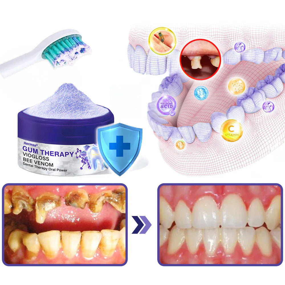 Hermsa® VioGloss Bee Venom Dental Therapy Oral Power