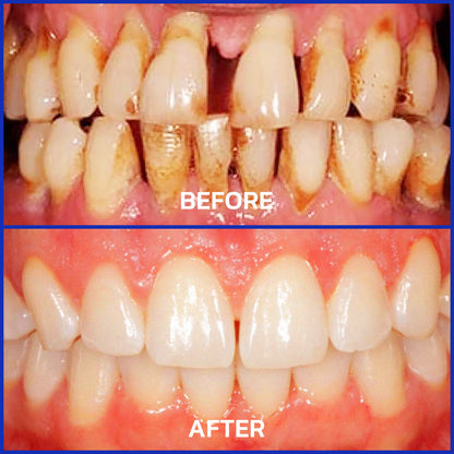 Hermsa® VioGloss Bee Venom Dental Therapy Oral Power